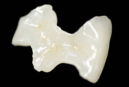 e.max