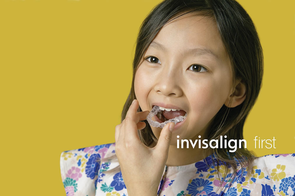 子どものインビザライン矯正